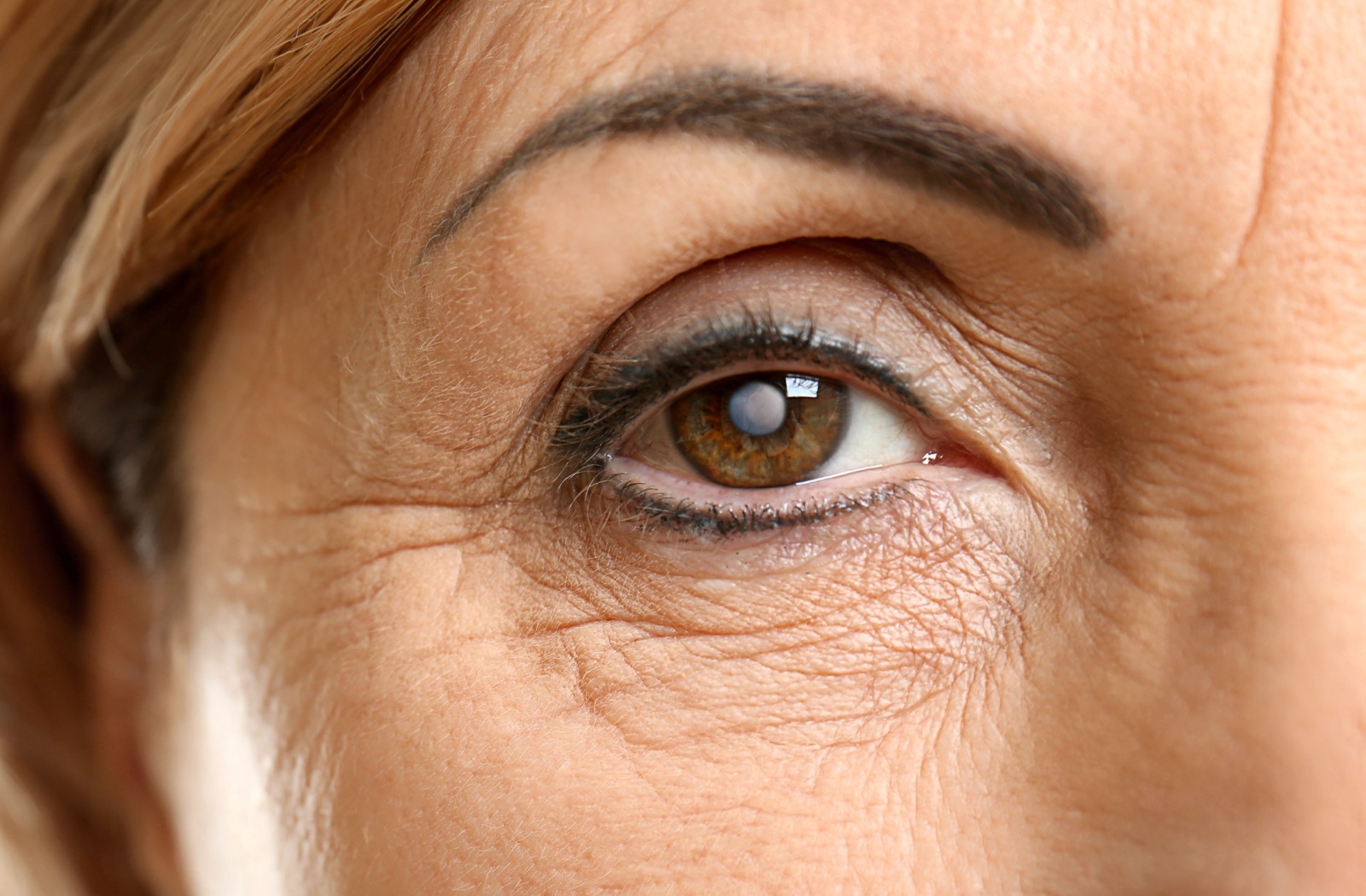 A close-up image of a senior's eye with a cataract beginning to develop.