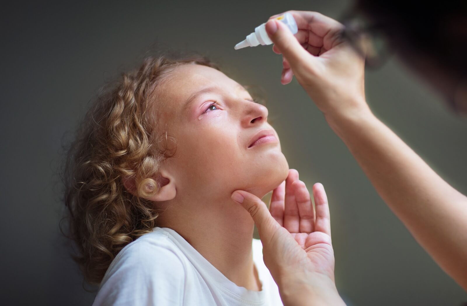 A parent tips up a child’s face to place eye drops into their red eye due to conjunctivitis