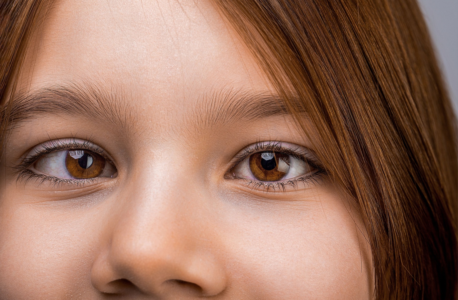Close-up of a child’s brown eyes and face, showing healthy eye alignment.